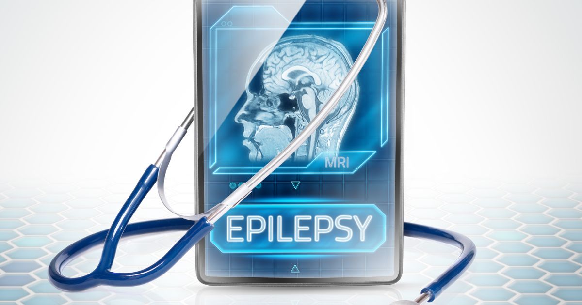 Epilessia